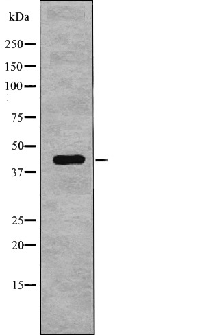 Anti-Phospho-NDRG1 (Thr346) Polyclonal Antibody