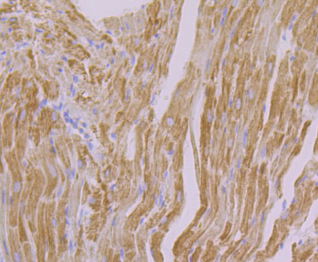 Anti-NDUFB8 Antibody (3W868)