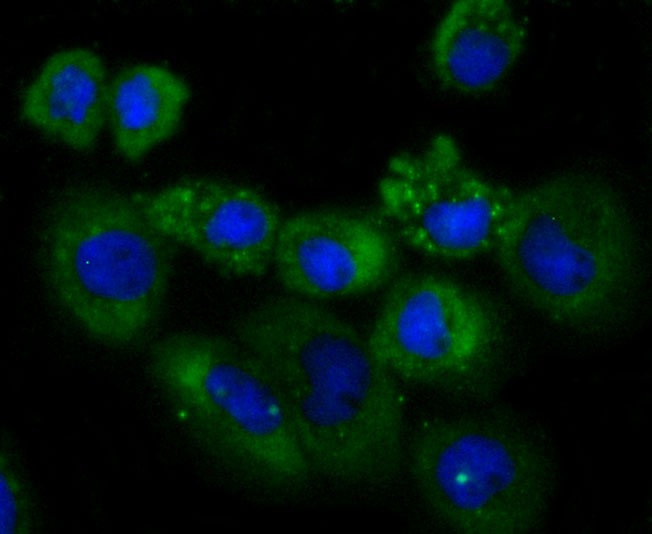 Anti-NDRG1 Antibody (7H760)