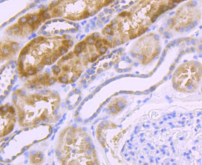 Anti-NDUFS3 Antibody (6M78)