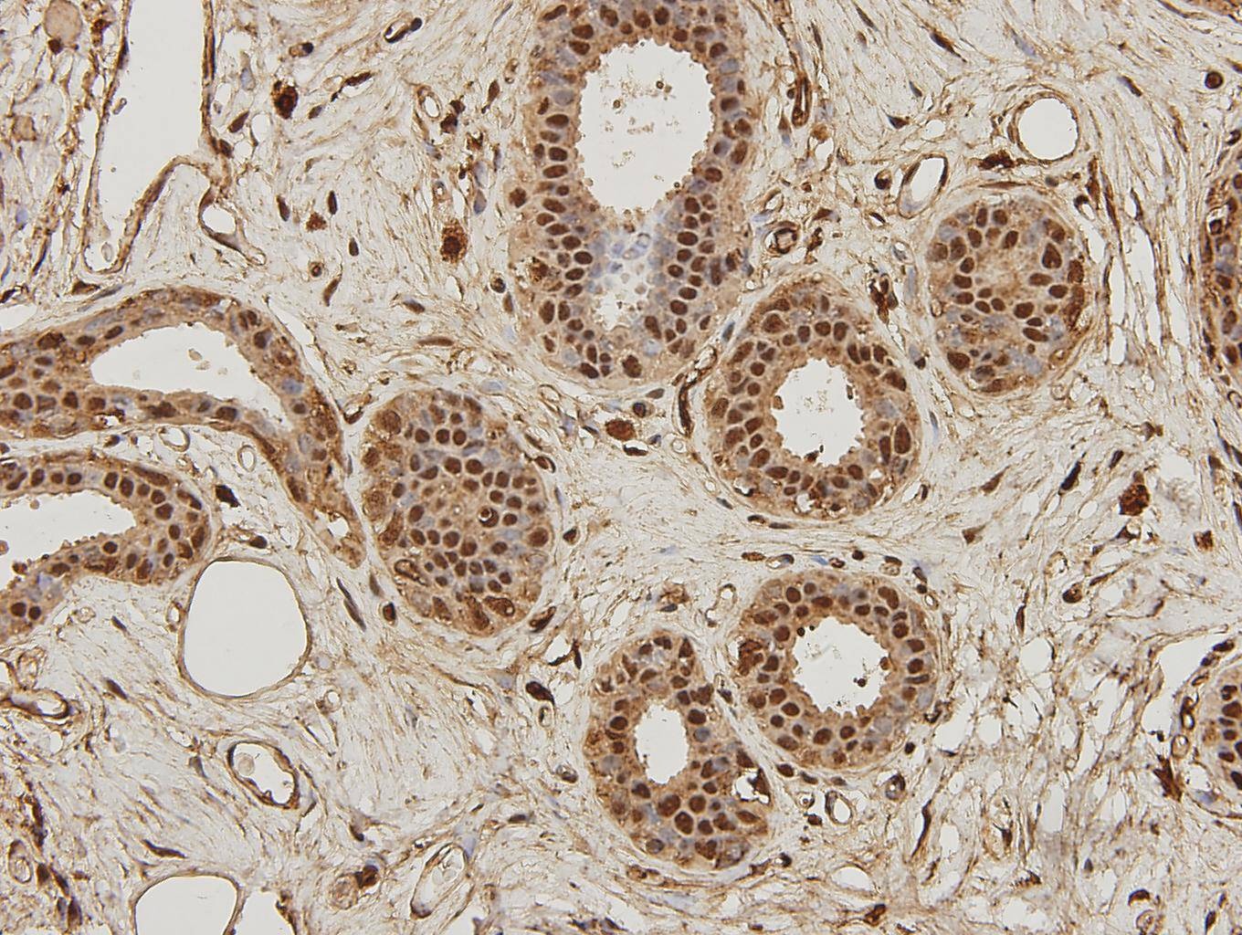 Anti-NFKB1 Antibody (6X277)
