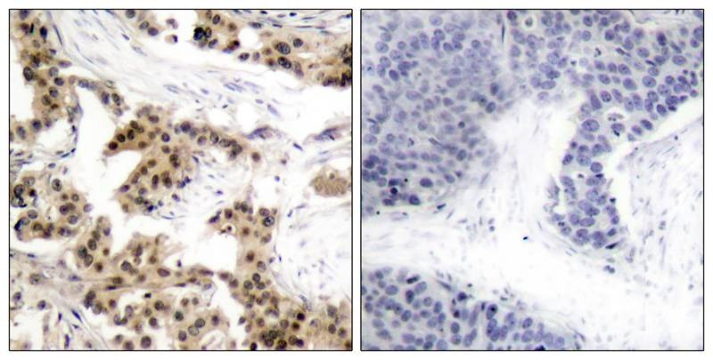 Anti-Phospho-NFKB1 (Ser893) Polyclonal Antibody