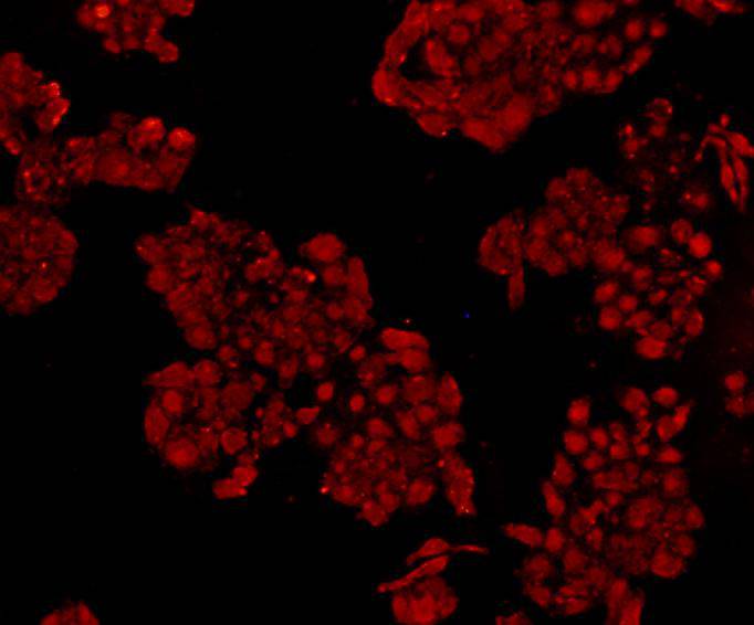 Anti-NFKB1 Antibody (6X277)