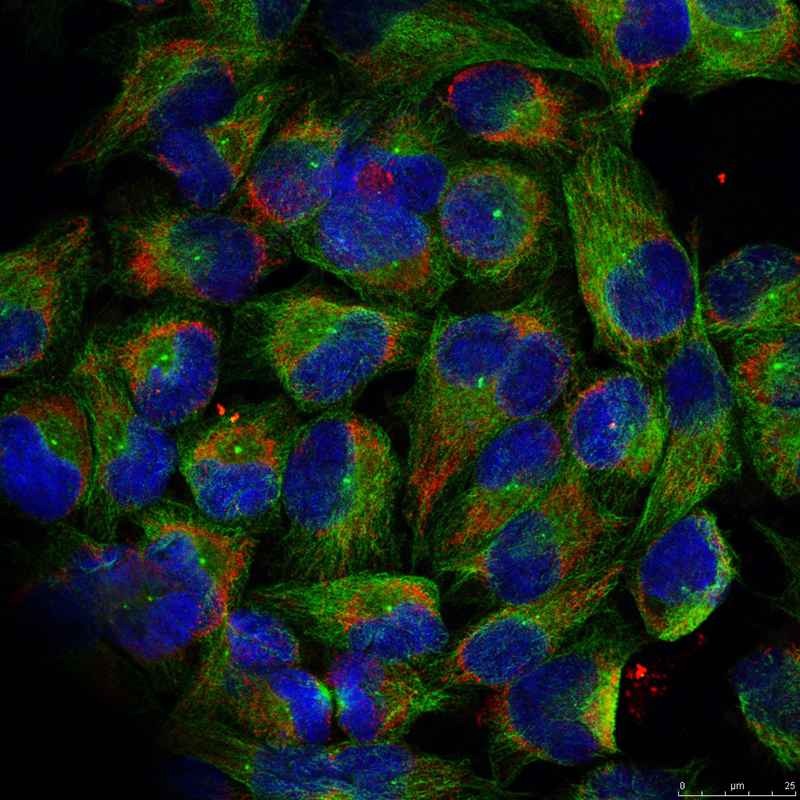 Anti-Phospho-NFkB p100 (Ser866) Polyclonal Antibody