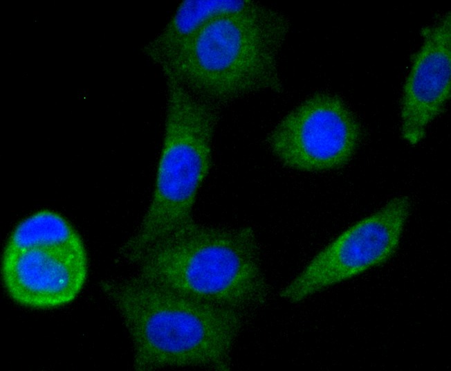 Anti-NDUFS3 Antibody (6M78)