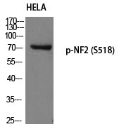 Anti-Phospho-Merlin (Ser518) Polyclonal Antibody