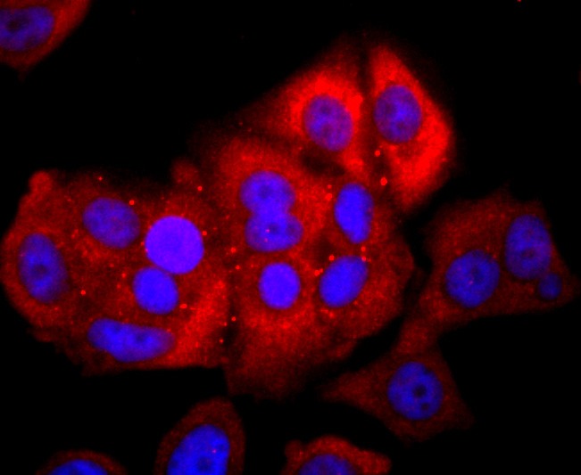 Anti-NFAT1 Antibody (4I426)