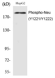 Anti-Phospho-HER2/ERBB2 (Tyr1221, 1222) Polyclonal Antibody 2