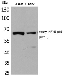Anti-Acetyl-NF-kB p65 (Lys218) Polyclonal Antibody