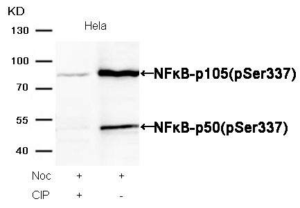 Anti-Phospho-NFKB1 (Ser337) Polyclonal Antibody 2