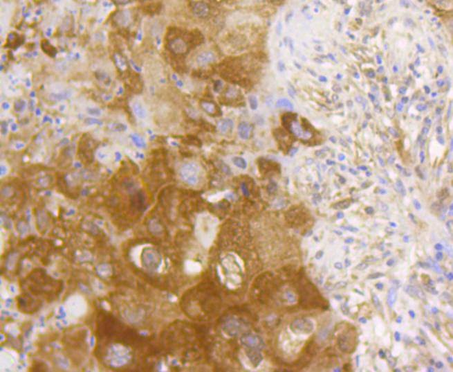 Anti-NF-kB p65 Antibody (4U638)