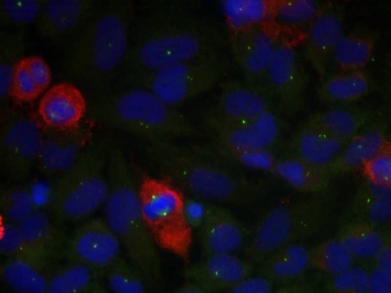 Anti-Phospho-NF-kB p65 (Thr435) Polyclonal Antibody 2