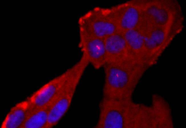 Anti-ELANE Antibody (2I484)
