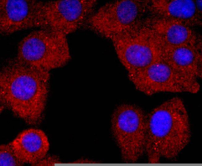 Anti-ELANE Antibody (2I484)