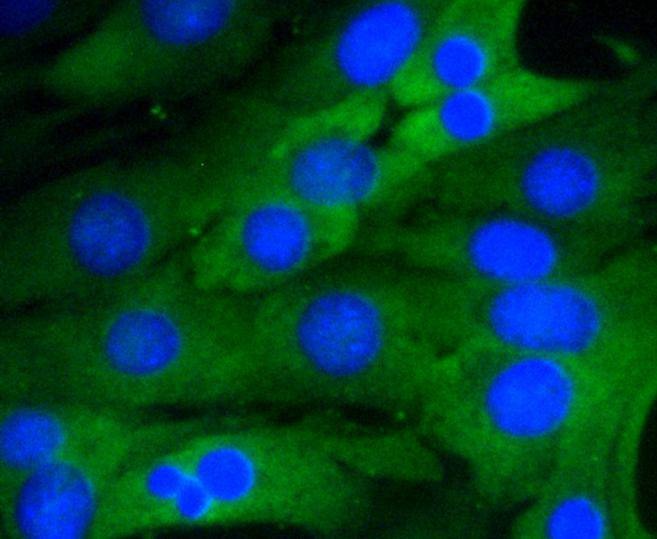 Anti-NF-kB p65 Antibody (4U638)