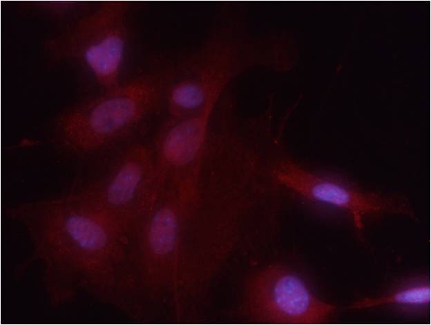 Anti-Phospho-NF-kB p65 (Ser536) Polyclonal Antibody 2