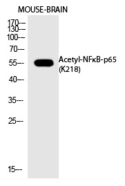 Anti-Acetyl-NF-kB p65 (Lys218) Polyclonal Antibody