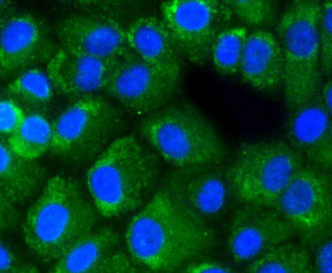 Anti-NF-kB p65 Antibody (4U638)
