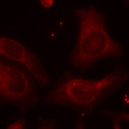Anti-Phospho-NFKB1 (Ser927) Polyclonal Antibody