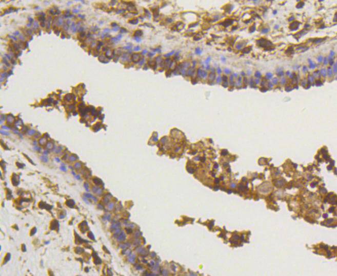 Anti-NF-kB p65 Antibody (4U638)