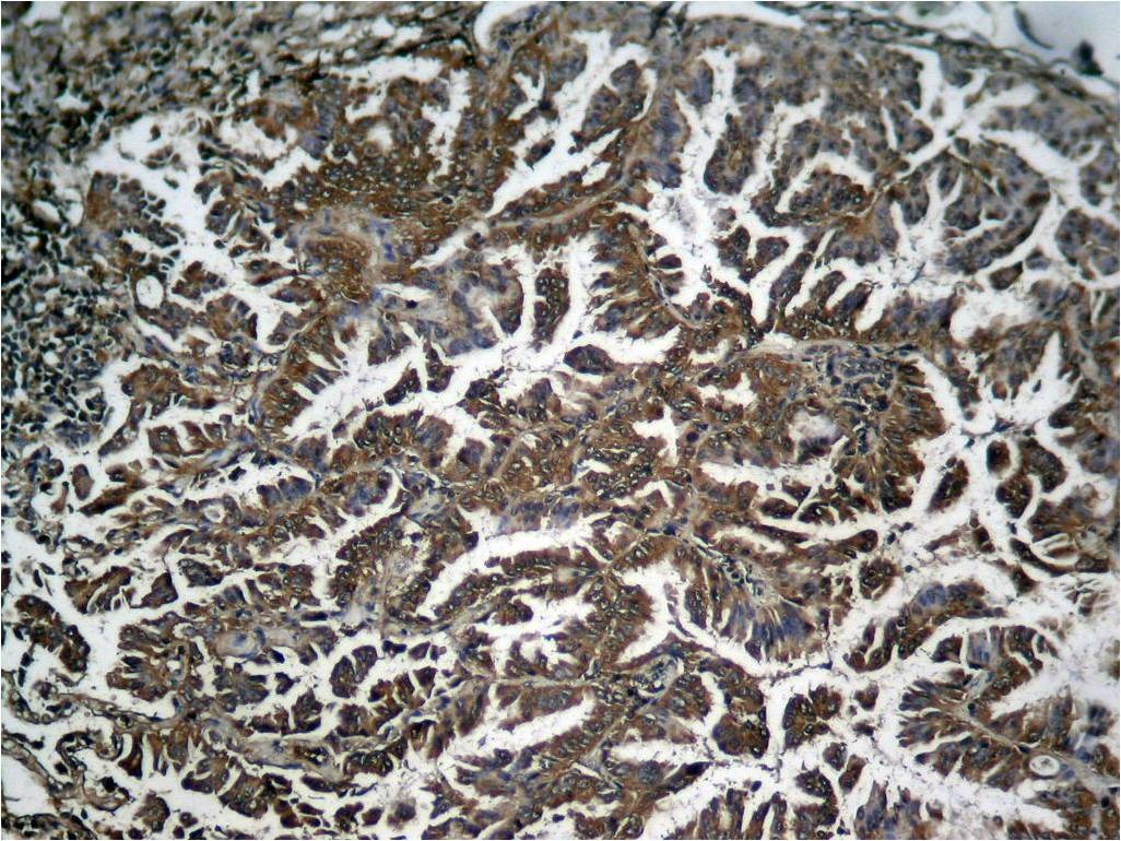 Anti-Phospho-NF-kB p65 (Ser536) Polyclonal Antibody 2