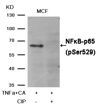 Anti-Phospho-NF-kB p65 (Ser529) Polyclonal Antibody