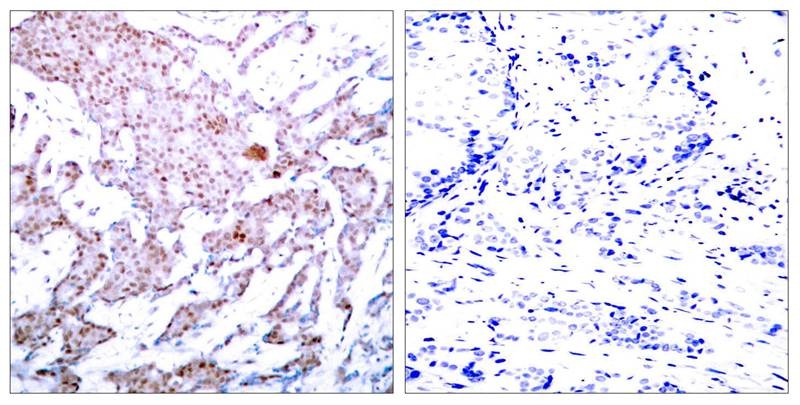 Anti-Phospho-NF-kB p65 (Ser536) Polyclonal Antibody 2