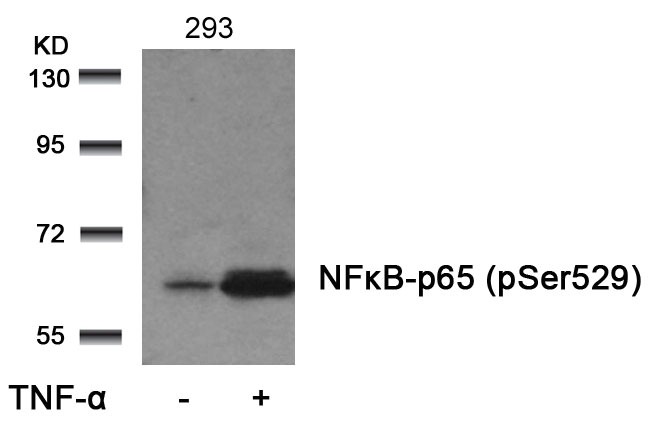Anti-Phospho-NF-kB p65 (Ser529) Polyclonal Antibody