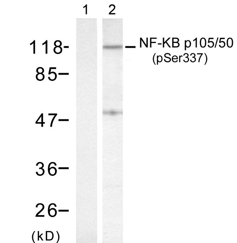 Anti-Phospho-NFKB1 (Ser337) Polyclonal Antibody 2