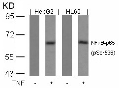 Anti-Phospho-NF-kB p65 (Ser536) Polyclonal Antibody 2