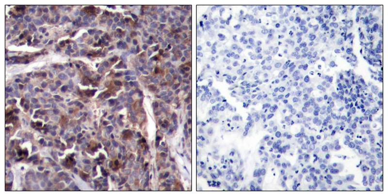 Anti-Phospho-NF-kB p65 (Thr505) Polyclonal Antibody