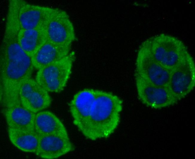 Anti-NFAT2 Antibody (1J539)