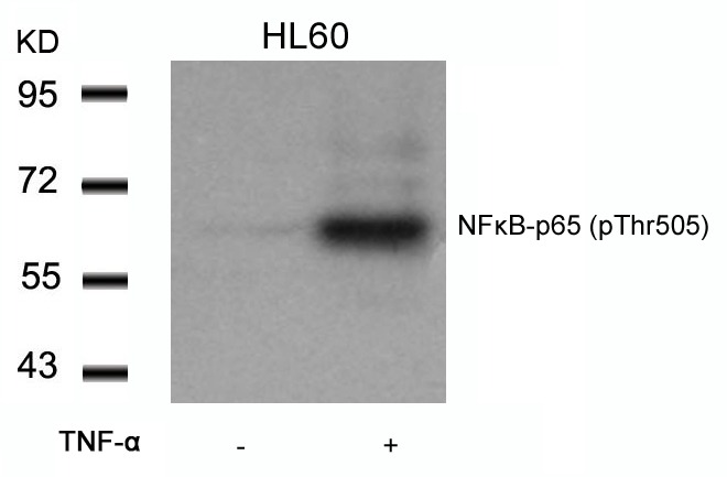 Anti-Phospho-NF-kB p65 (Thr505) Polyclonal Antibody