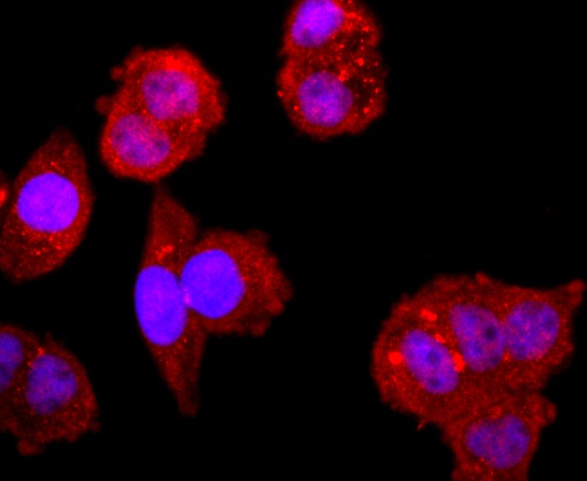 Anti-NFAT1 Antibody (4I426)