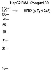 Anti-Phospho-HER2/ERBB2 (Tyr1248) Polyclonal Antibody