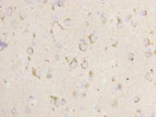 Anti-NRP1 Antibody (2L415)