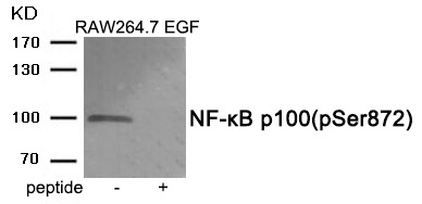 Anti-Phospho-NFkB p100 (Ser872) Polyclonal Antibody