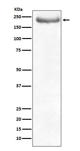Anti-NEFH Antibody (9O45)