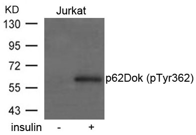 Anti-Phospho-p62Dok (Tyr362) Polyclonal Antibody