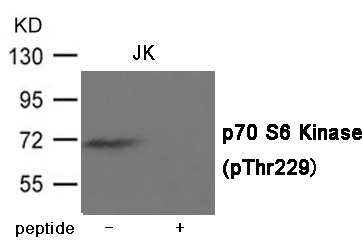 Anti-Phospho-S6K1/RPS6KB1 (Thr229) Polyclonal Antibody
