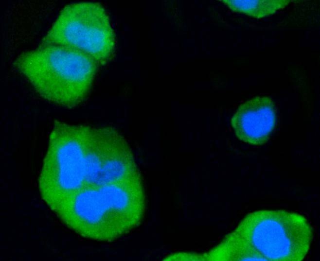 Anti-MAPK14 Antibody (6V701)