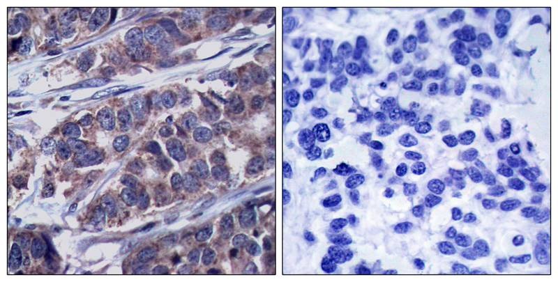 Anti-Phospho-p62Dok (Tyr362) Polyclonal Antibody