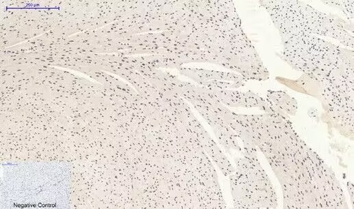 Anti-Phospho-MAPK14 (Tyr323) Polyclonal Antibody