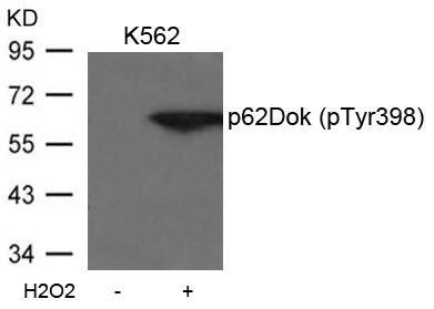 Anti-Phospho-p62Dok (Tyr398) Polyclonal Antibody