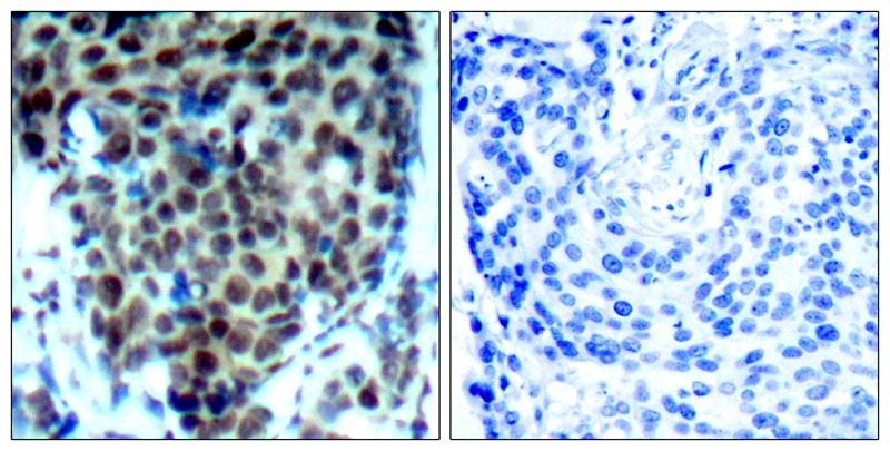 Anti-Phospho-MAPK14 (Thr180) Polyclonal Antibody
