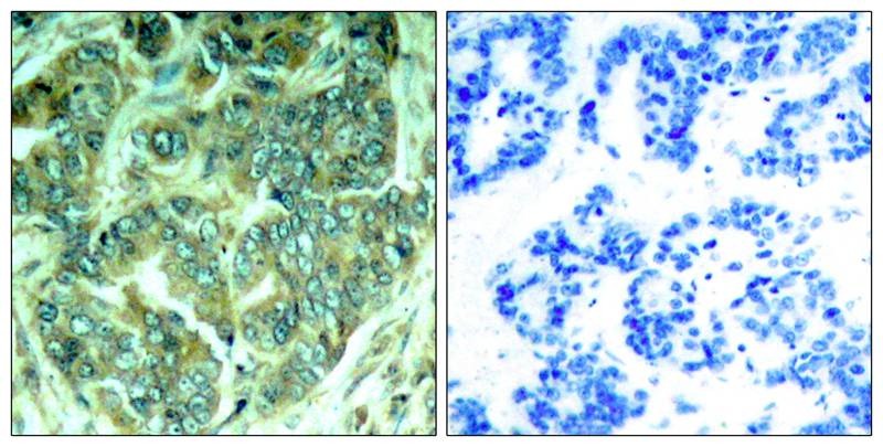 Anti-Phospho-p62Dok (Tyr398) Polyclonal Antibody