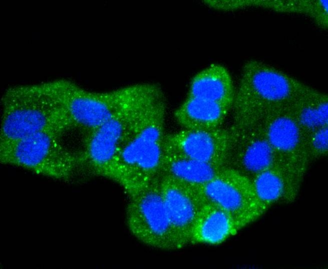 Anti-CDH1 Antibody (5F903)