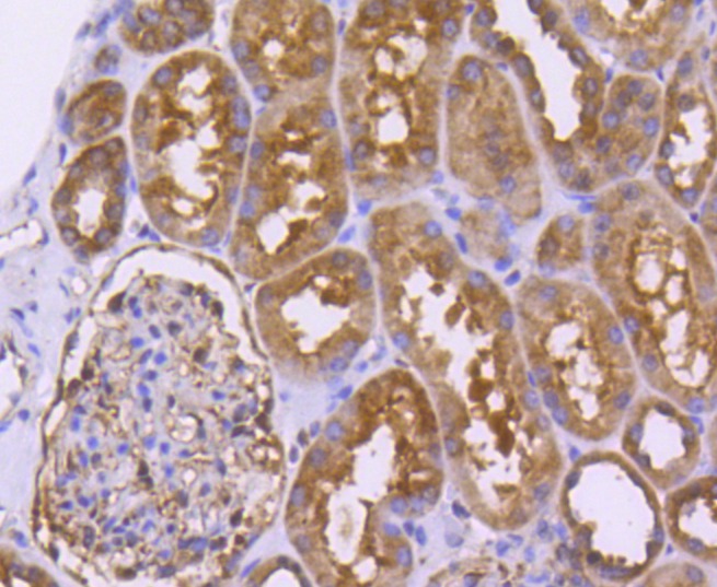 Anti-PARK7/DJ1 Antibody (9Q473)