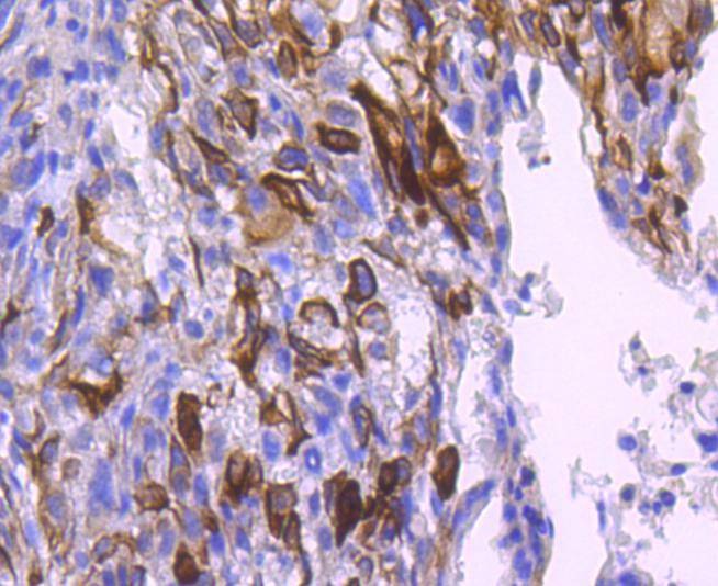 Anti-Phospho-AKT1 (Ser124) Antibody (1H96)