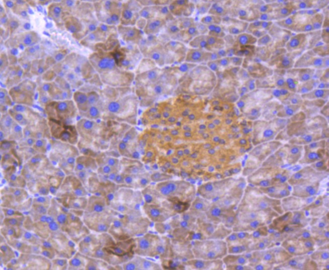 Anti-PARK7/DJ1 Antibody (9Q473)